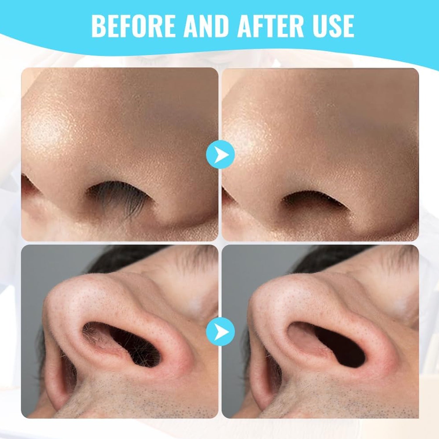 Two sets of before and after images show clean nostrils after using the nose hair trimmer.