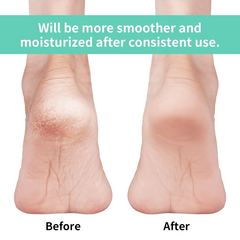 Infographic illustrating key features of the anti-crack silicone heel socks.