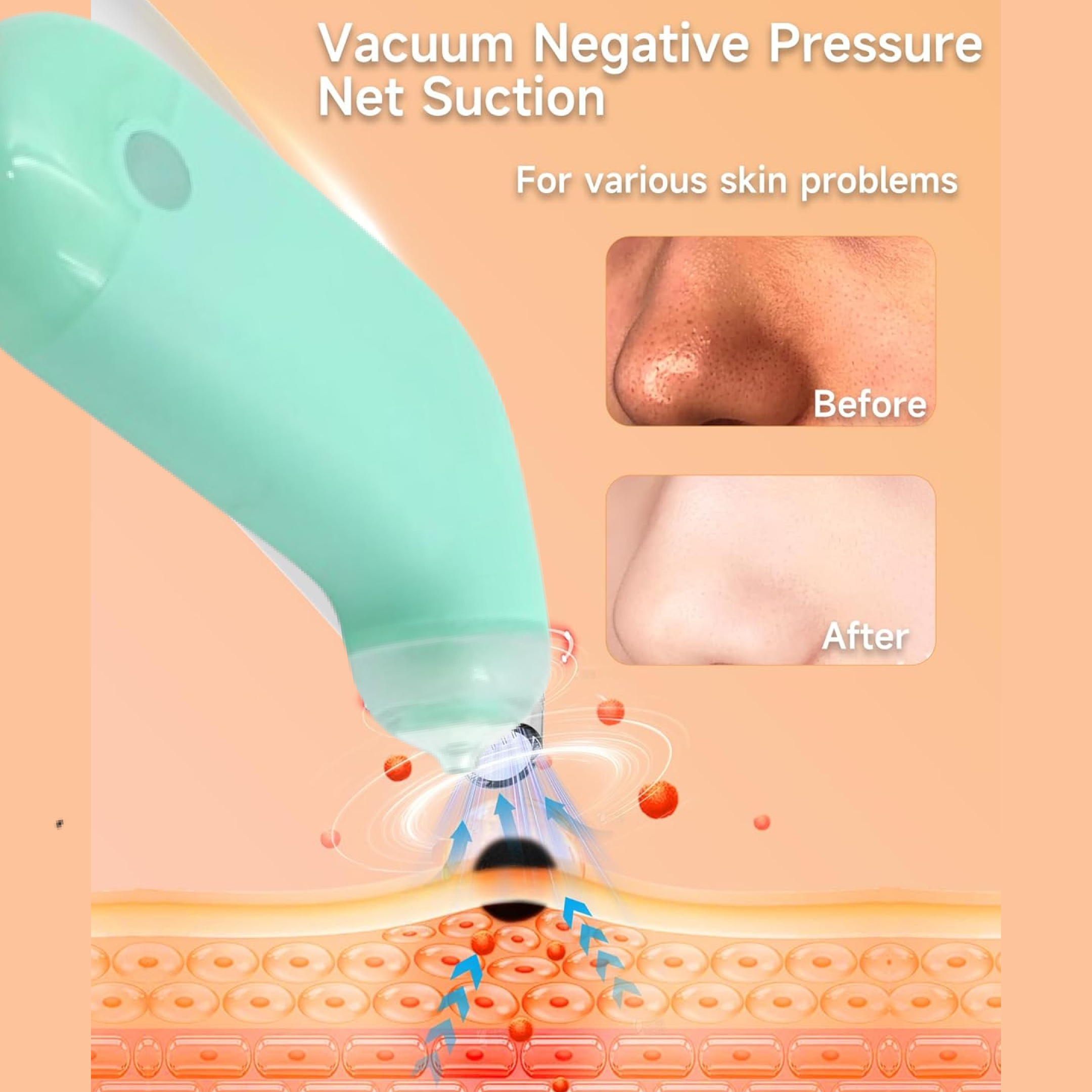 Vacuum Blackhead Remover Machine – Mini Handheld Facial Pore Cleaner & Lifting Massage Device for Deep Skin Care, Oil Control & Smooth Skin (1 Pc)