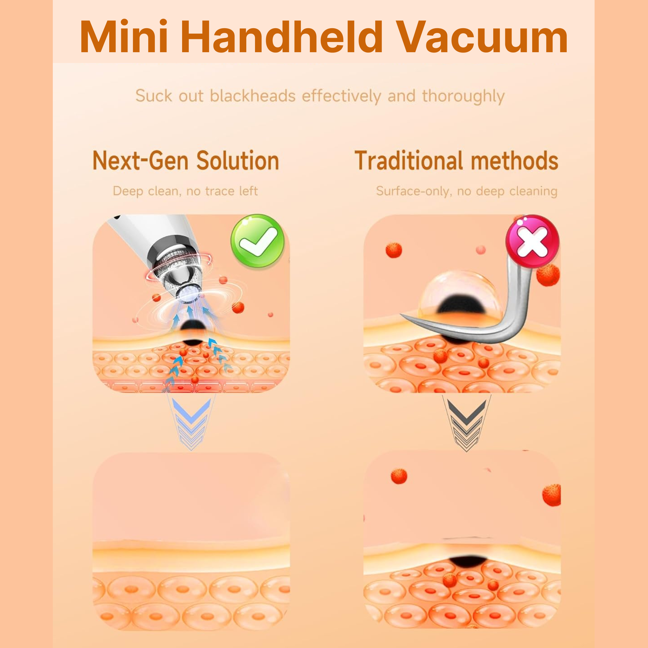 Vacuum Blackhead Remover Machine – Mini Handheld Facial Pore Cleaner & Lifting Massage Device for Deep Skin Care, Oil Control & Smooth Skin (1 Pc)